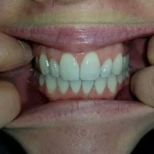 Smile Image