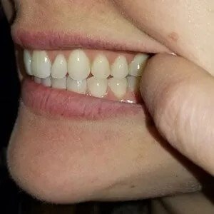 Smile Image
