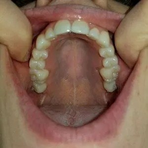 Smile Image