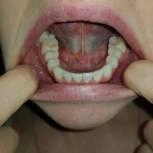 Smile Image