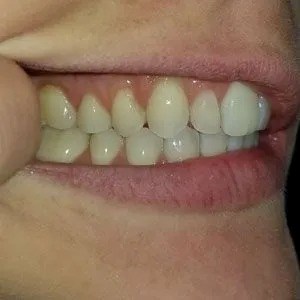 Smile Image